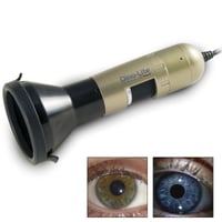 Dino-Lite Iriscope: Erstellen Sie ganz einfach scharfe Bilder der Augen und Iris