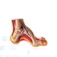 Freilegung der Fußhöhle