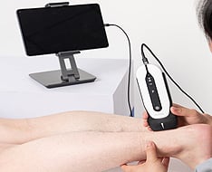 Chison Sonoeye Ultraschallgeräte