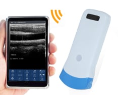 SonoStar Sonographen