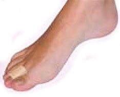 Schutz und Vorlagen aus Silikon und Gel