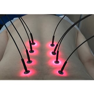 Nadelsystem Nadel 8-Faserlicht Light: Konvertieren 1 Laserausgang 8 Punkte auf einmal