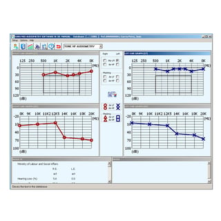 Sibelmed W5O Software für Sibelmed 400 Audiometer