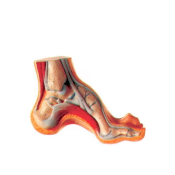 Freilegung der Fußhöhle