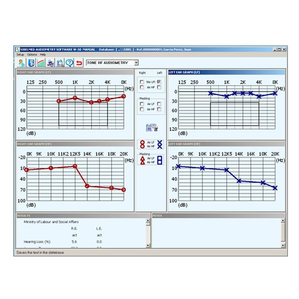 Sibelmed W5O Software für Sibelmed 400 Audiometer