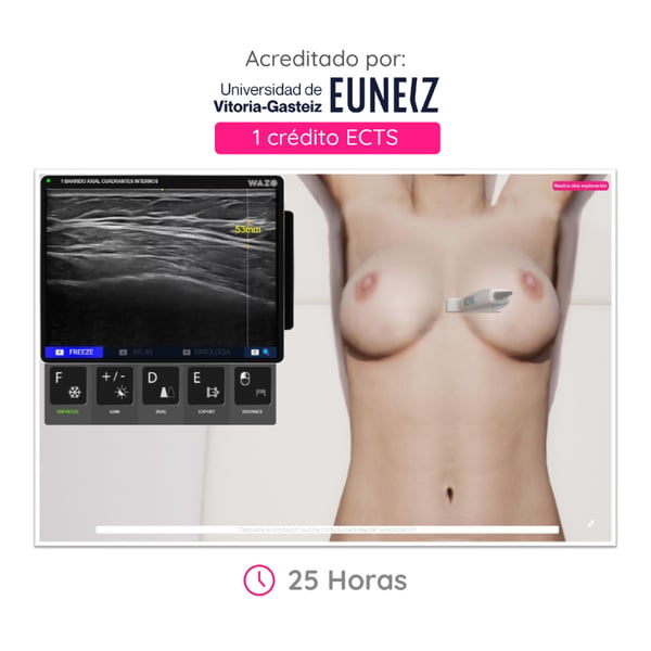 WAZO CAMPUS: Online-Kurs für Brustultraschall. Offizielles Universitätszertifikat der Universität Vitoria-Gasteiz (EUNEIZ).