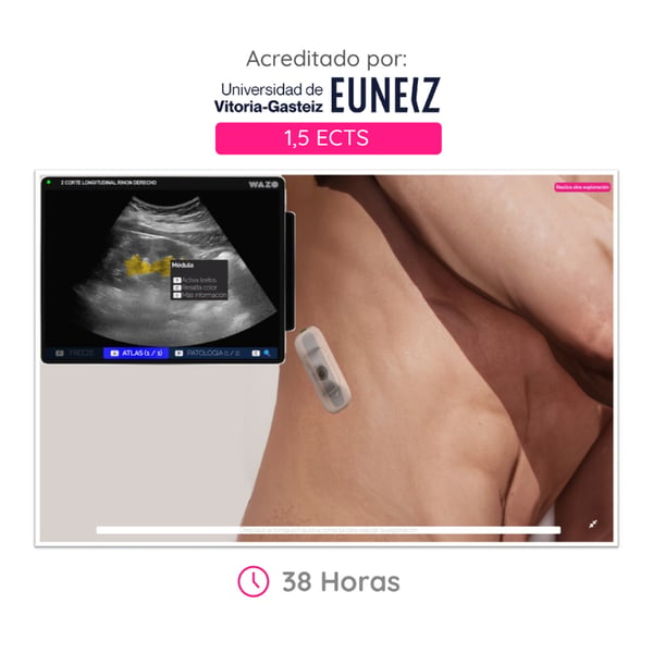 WAZO CAMPUS: Online-Kurs für Brustultraschall. Offizielles Universitätszertifikat der Universität Vitoria-Gasteiz (EUNEIZ).