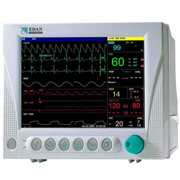 Tragbarer Multiparameter-Vitalzeichenmonitor mit 10,1-Zoll-Farbbildschirm Edan M08B