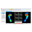 Biomechanische Drücke Plattform Gait Analyse Pedistar 3D Pro Inklusive Gateway Geschenk!