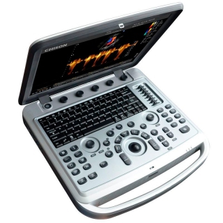 Chison Sonobook6 tragbares Ultraschallgerät mit einer Auswahl an Sonden – OCCASION