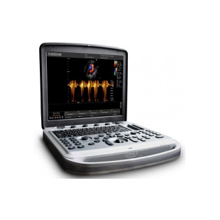 Tragbares Ultraschallsystem Chison Sonobook 8 mit einer Auswahl an Sonden - GEBRAUCHT