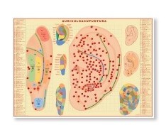 Stiche von Aurikulopunktur Stiche von Aurikulopunktur