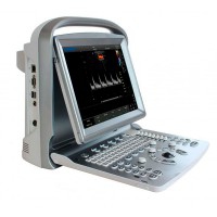 Chison ECO6 Tragbares Ultraschallgerät