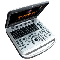 Chison Sonobook6 tragbares Ultraschallgerät