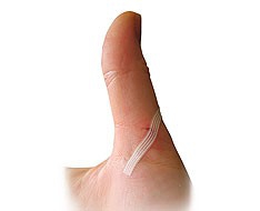 Wundverschluss Wundverschluss