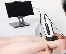 Chison Sonoeye Ultraschallgeräte Chison Sonoeye Ultraschallgeräte