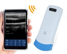 SonoStar Sonographen SonoStar Sonographen