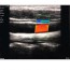 SonoStar Wireless Portable Ultrasound: Farbdoppler, 10 MHz Linearsonde / 128 Elemente + Geschenk iPad! SonoStar Wireless Portable Ultrasound: Farbdoppler, 10 MHz Linearsonde / 128 Elemente + Geschenk iPad!