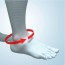 Equine Foot Splint: Wird für Fallfußdeformitäten verwendet