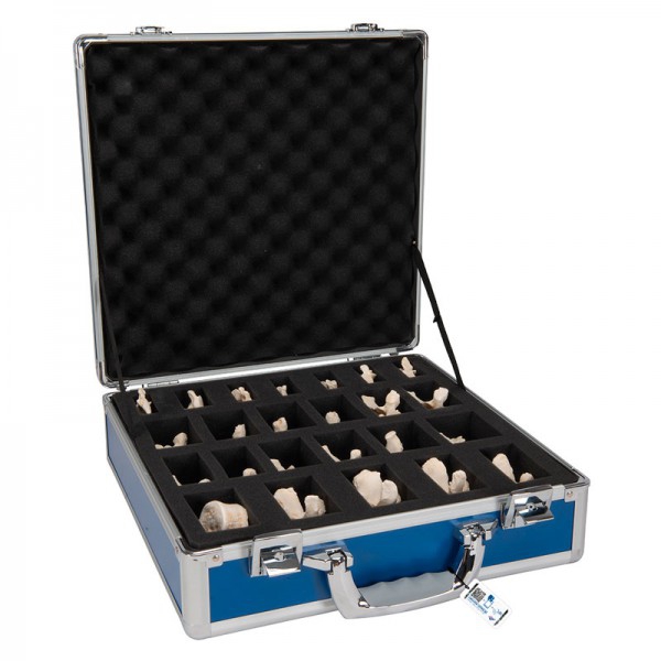 Satz von 24 KNOCHENartigen Wirbeln Satz von 24 KNOCHENartigen Wirbeln